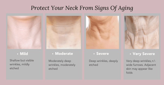 How to Treat Reduce and Prevent Neck Wrinkles Sagging